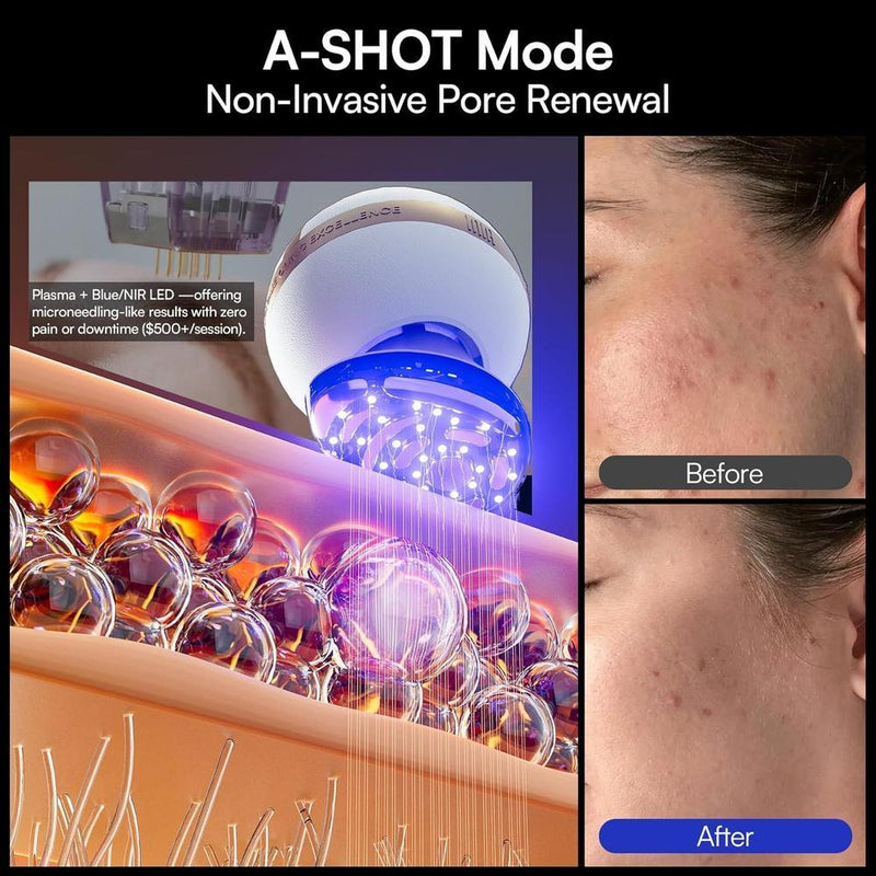 Dispositivo facial microcorriente 8 en 1 INIA SPHERA con luz roja, tratamiento térmico y modos personalizados para cuidado en casa