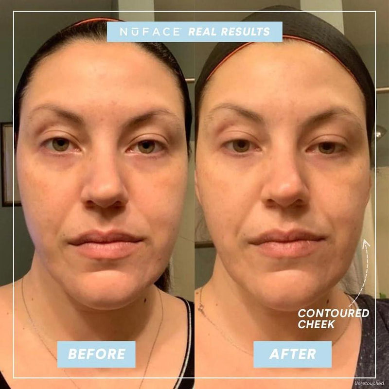 Dispositivo portátil NuFACE Mini para tonificación de la piel del rostro, mejora el contorno y reduce líneas finas