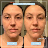 Dispositivo portátil NuFACE Mini para tonificación de la piel del rostro, mejora el contorno y reduce líneas finas
