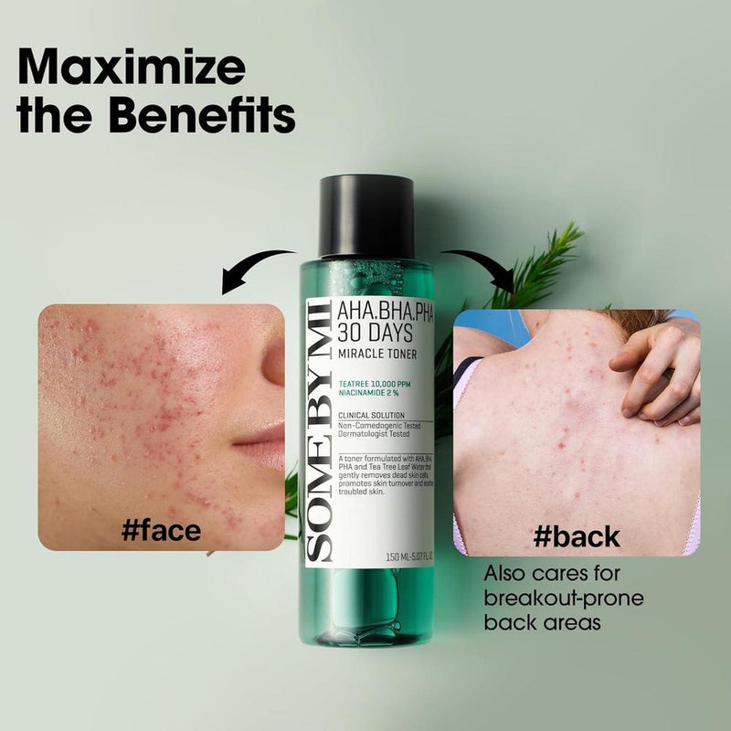 SOME BY MI AHA BHA PHA 30 Days Miracle Toner - Exfoliación suave y cuidado de poros para todo tipo de piel, ideal para piel propensa al acné
