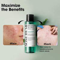SOME BY MI AHA BHA PHA 30 Days Miracle Toner - Exfoliación suave y cuidado de poros para todo tipo de piel, ideal para piel propensa al acné