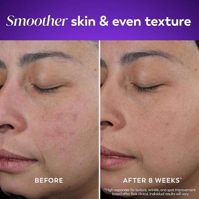 Olay Crema De Noche De Retinol Para Mujeres Hidratante Antiarrugas Sin Fragancia No Grasa 50.3ml