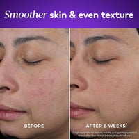 Olay Crema De Noche De Retinol Para Mujeres Hidratante Antiarrugas Sin Fragancia No Grasa 50.3ml