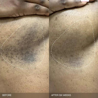 Faded Pack Iluminador para Manchas en Rostro y Cuerpo (SIN AROMA)