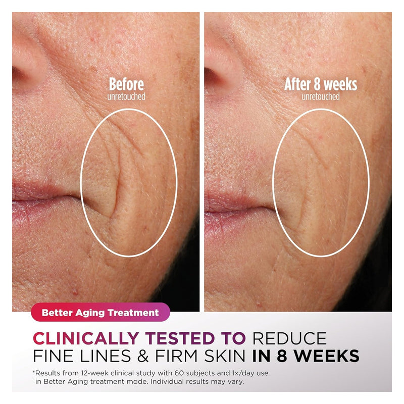 Shark CryoGlow Mascarilla LED Facial - Lila Chill