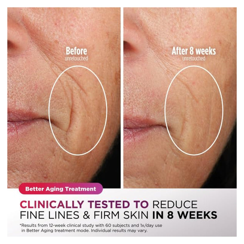 Shark CryoGlow Mascarilla LED Facial - Rose Glow