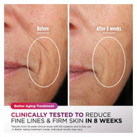 Shark CryoGlow Mascarilla LED Facial - Rose Glow