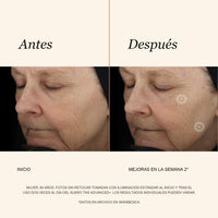 SkinMedica TNS Advanced+ - Suero Facial Multipéptido Antiedad (28.4 ml)
