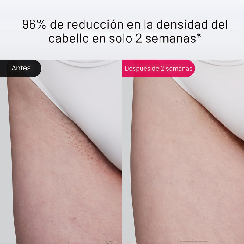 Ulike Air 10 Deluxe - Depiladora IPL con Enfriamiento por Hielo, Indolora y Permanente