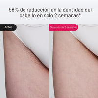Ulike Air 10 Deluxe - Depiladora IPL con Enfriamiento por Hielo, Indolora y Permanente