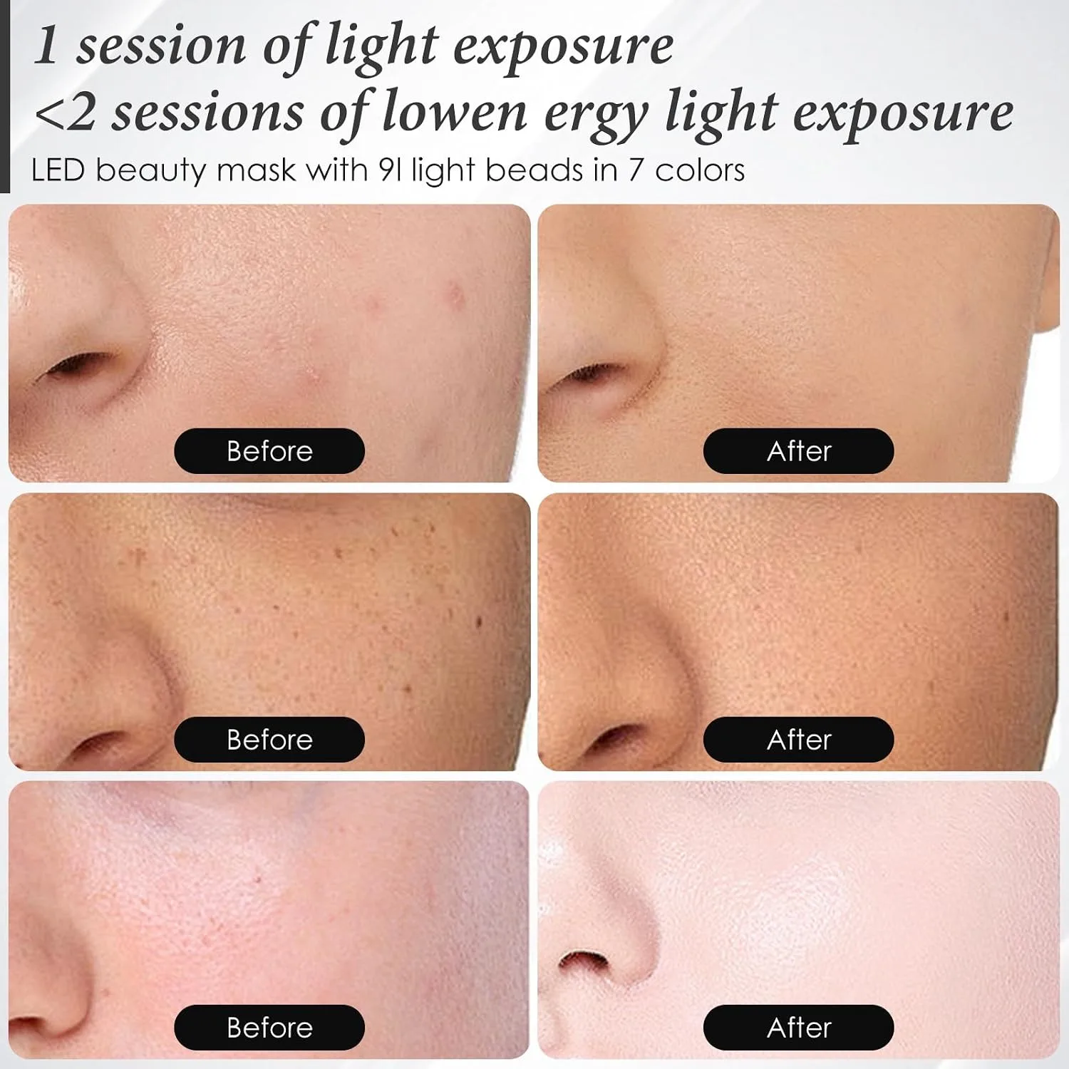 SDKWDH Red Light Therapy for Face, 850nm NIR Mask, Reduce Acne and Wrinkles