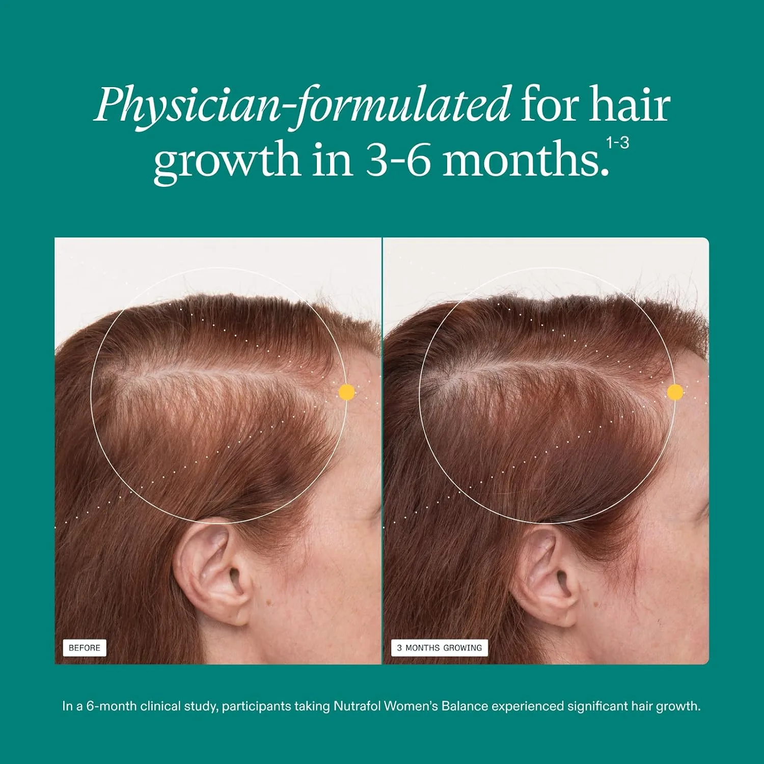 Nutrafol Women's Balance Hair Growth Supplements, Age 45+, 1-Month Bottle