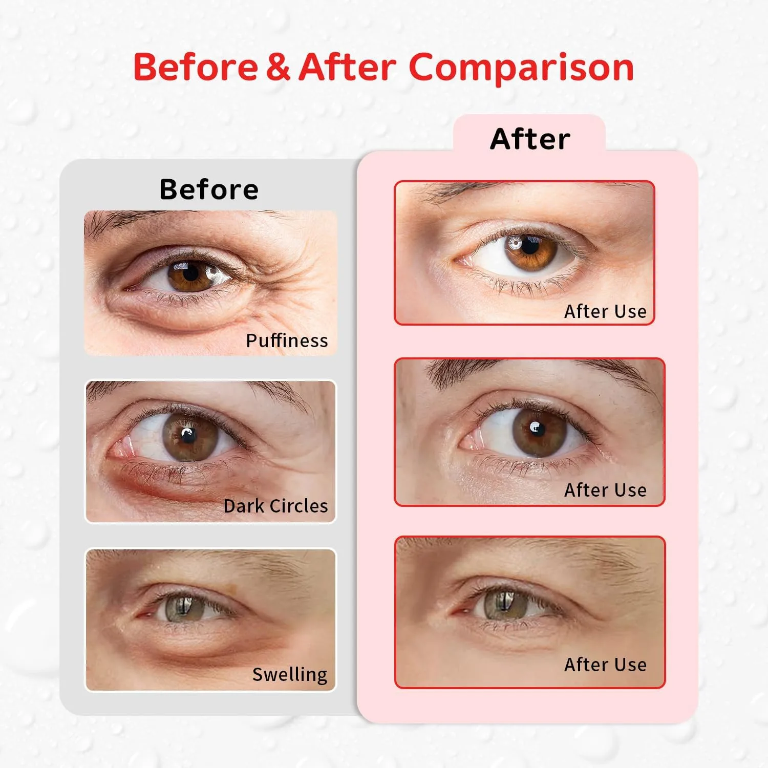 4PCS Gel Eye Ice Pack Set Reusable, Cold and Hot Compress for Eyes