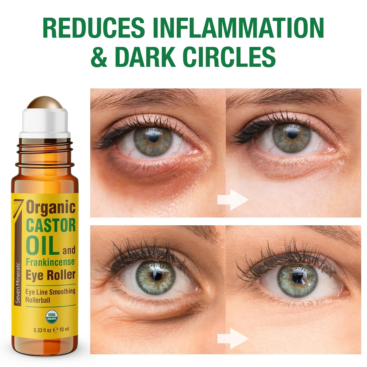 Seven Minerals Organic Castor Oil Roll On Eye Roller for Under Eye Bags, Dark Circles & Wrinkles - Organic Blend of Castor Oil And Frankincense - Brightens, and Revitalizes Skin & Face - 0.33 fl oz