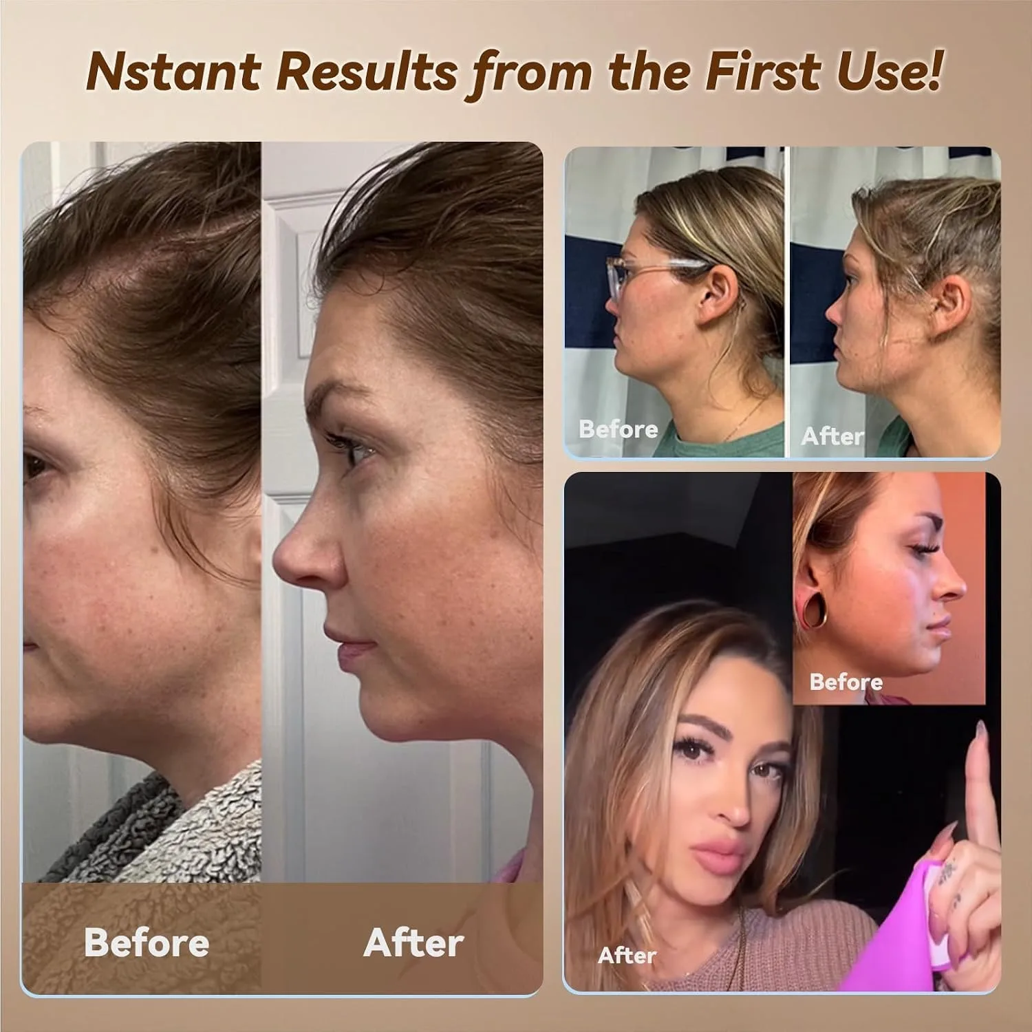 JUSRON V-Line Mask Chin Up Mask Face Strap, chin lifting mask (Light Blue)