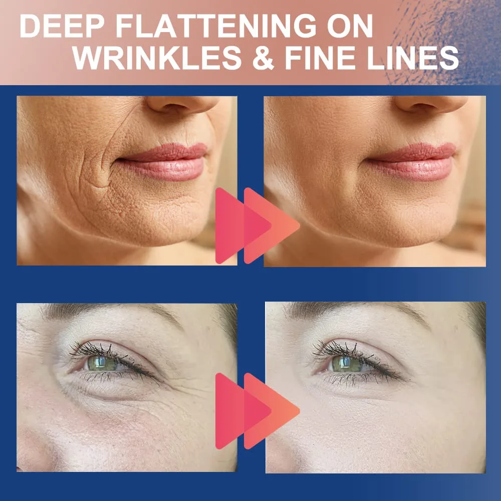 Akissos 2 Rolls Anti Wrinkle Patches Face Patches Neck Patches Unisex For Firming and Tightening Skin 2.5cm*5m