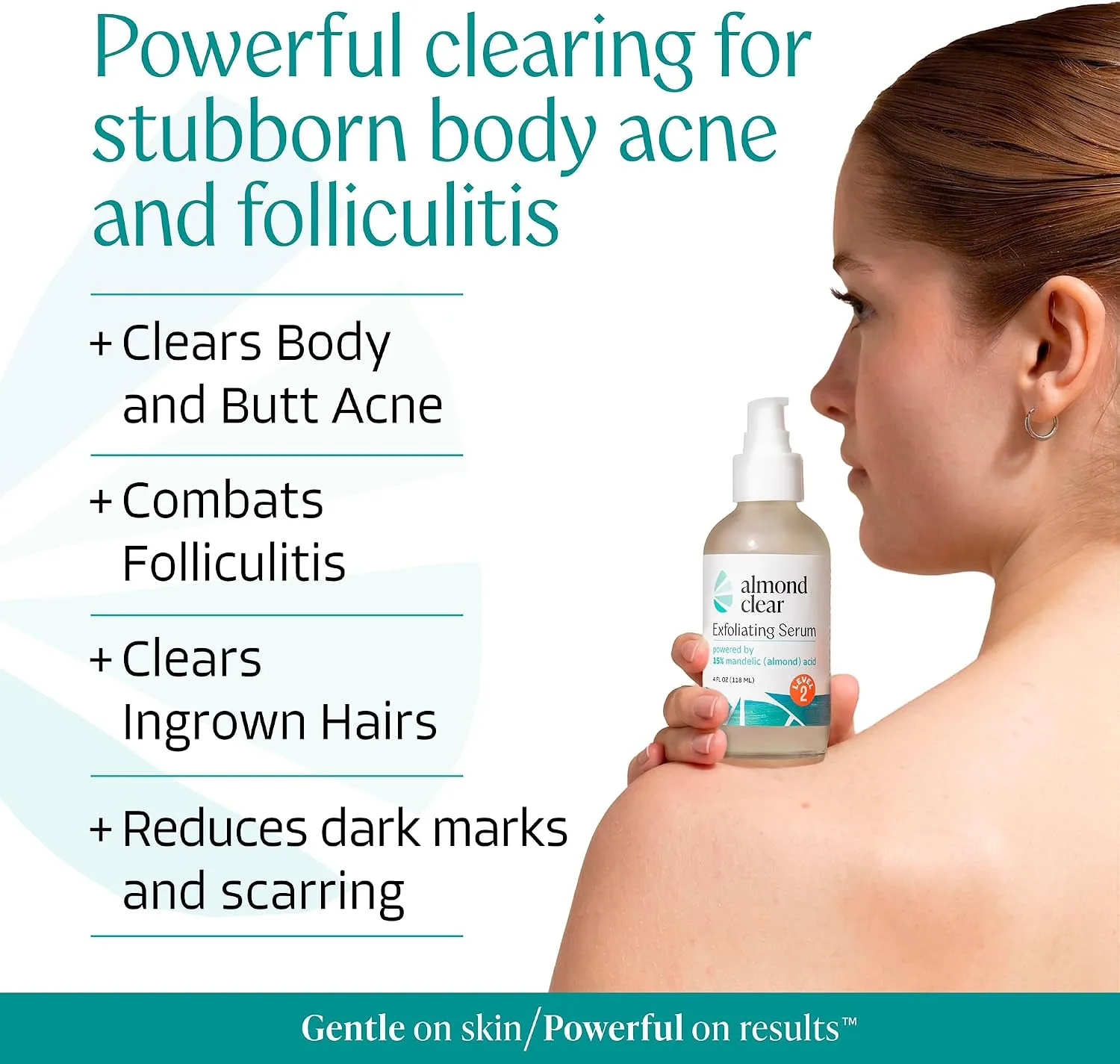Almond Clear Mandelic Acid Level 2 Serum – Extra Strength Treatment for Body Acne, Folliculitis, and Ingrown Hairs – Buttocks Clearing Dark Spot Remover – 1 Fl Oz