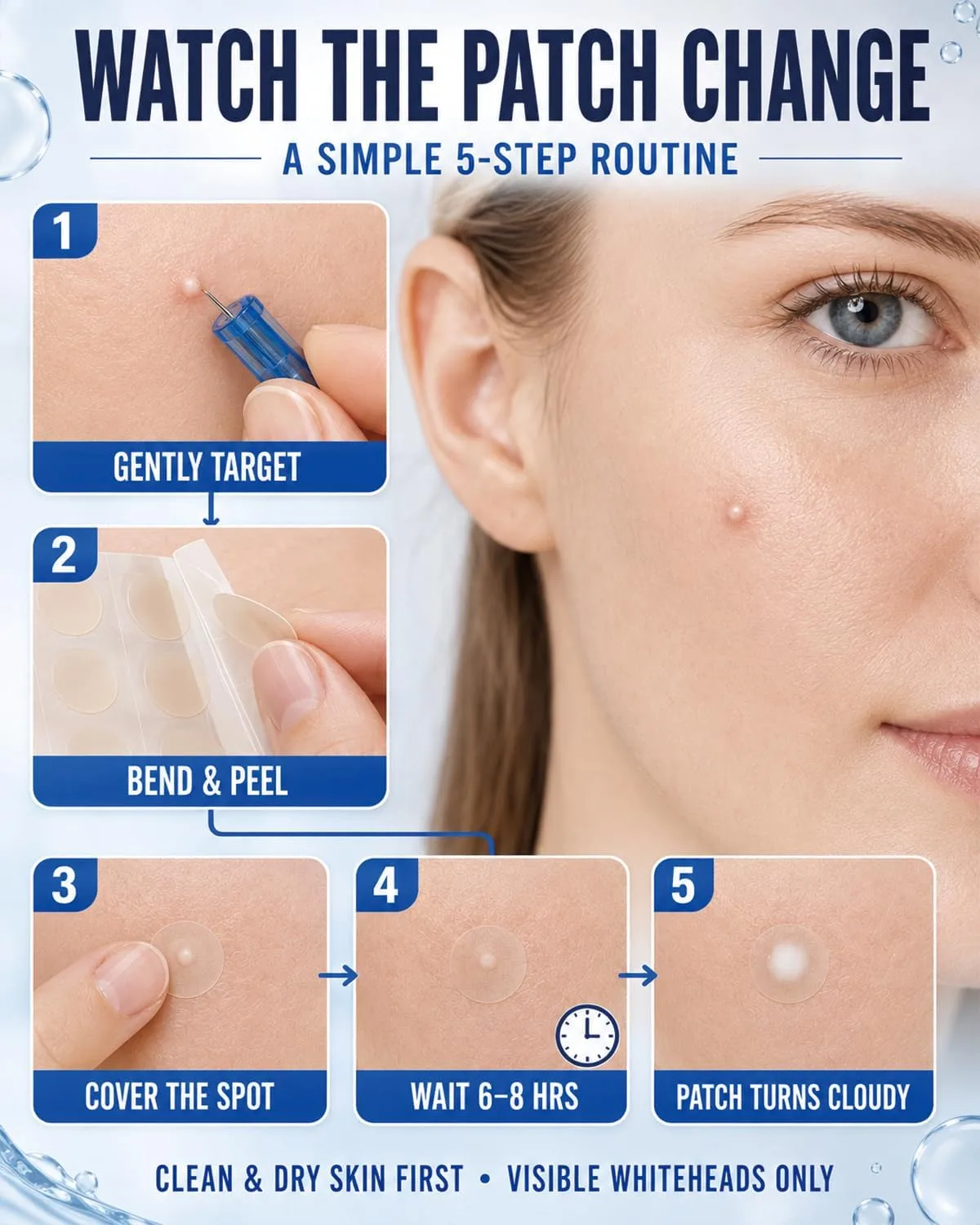 50 Disposable Pimple Needles with 72 Pimple Patches for Face