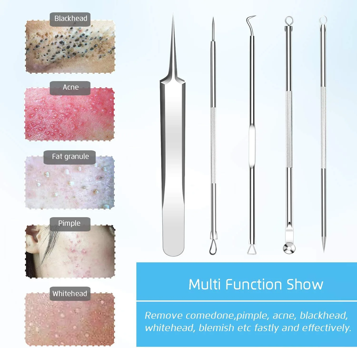 Best Blackhead Remover, Blackheads Blemish Removing, Acne Whitehead Removal Kit, Pimple Comedone Extractor Tool, Popper Pimples Treatment, with Tweezers, Risk Free for Face Forehead Nose