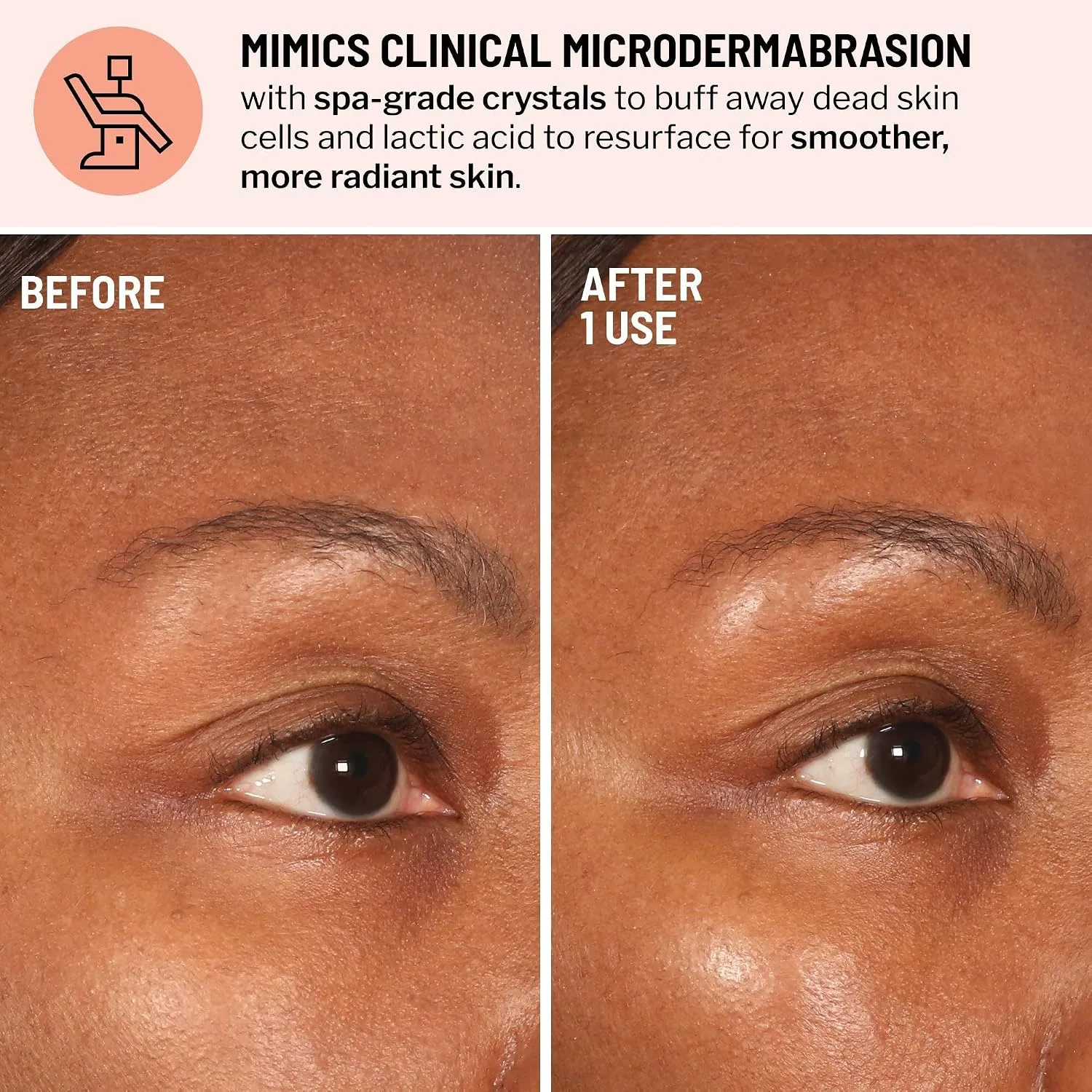 Dr. Brandt Advanced Microdermabrasion Face Exfoliator - 2.1 oz