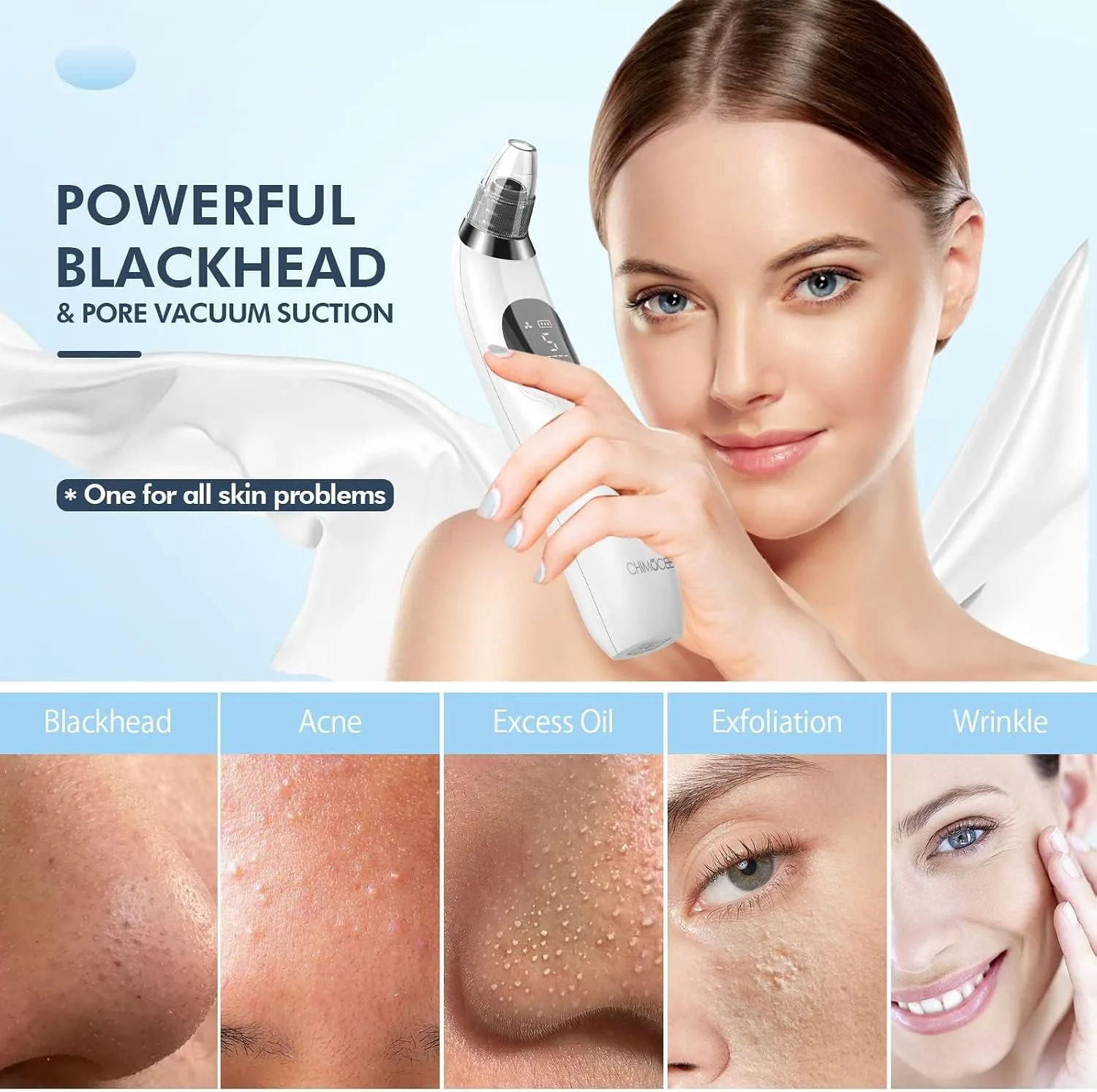 Blackhead Remover Pore Vacuum, Upgraded Black Head Remover for Face, Electric Acne Comedone Whitehead Extractor Tools-5 Suction Power, 5 Probes, USB Rechargeable Pimple Popper Tool Kit