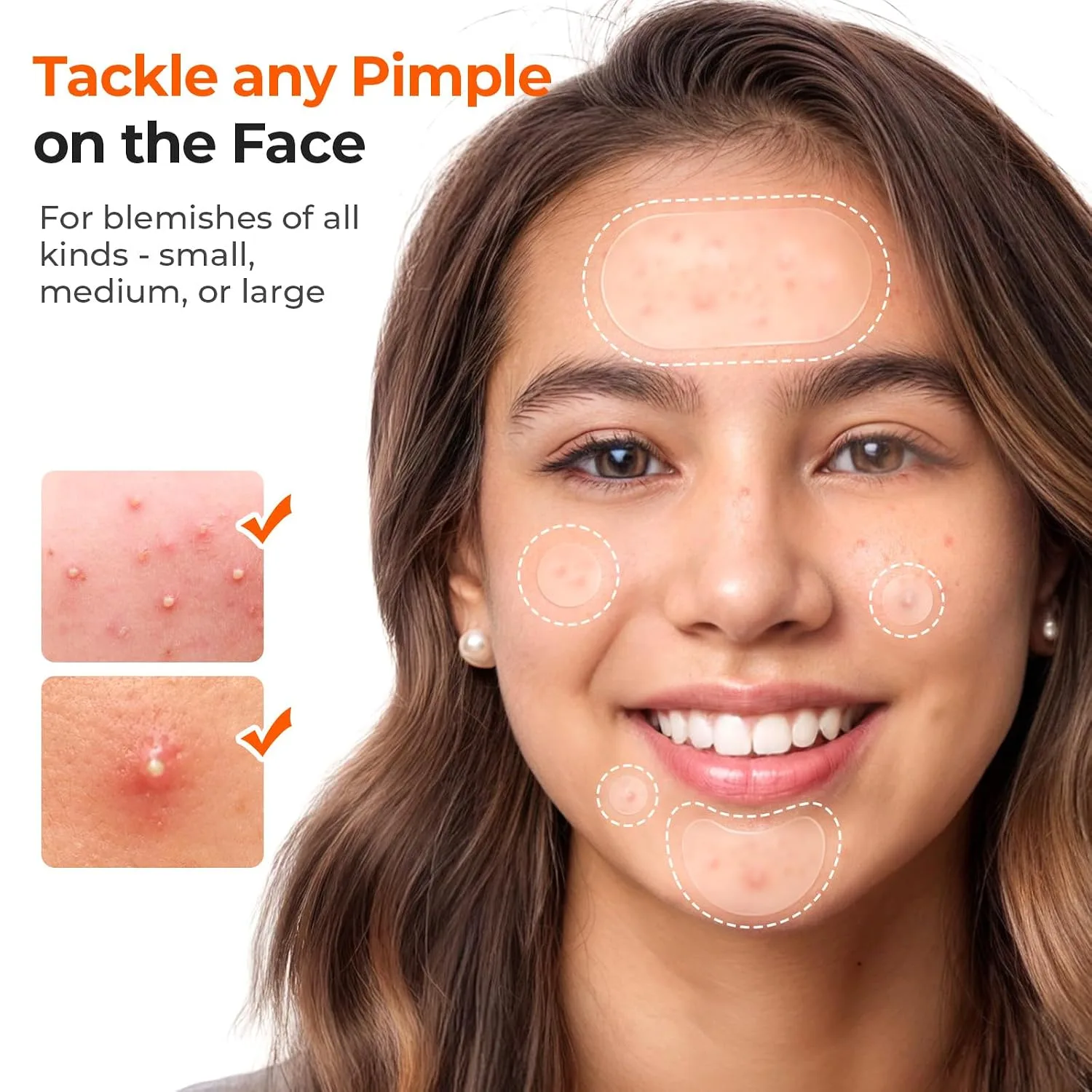 TKTK 443 Count Pimple Patches for Face, Hydrocolloid Acne Cover Patch Bulk