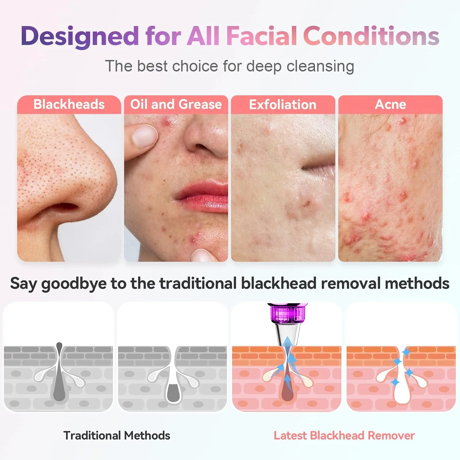 Blackhead Remover Vacuum, Facial Pore Extractor, 5 Suction Levels, 5 Probes