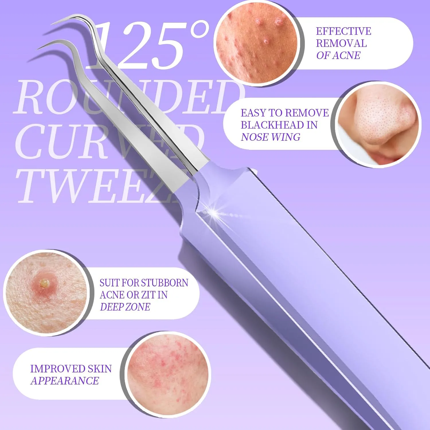 Teenitor Pimple Popper Tool Kit and Blackhead Remover Tools, Ingrown Hair Tweezers, Professional Blackhead Extractor Pimple Extractor Comedone Extractor