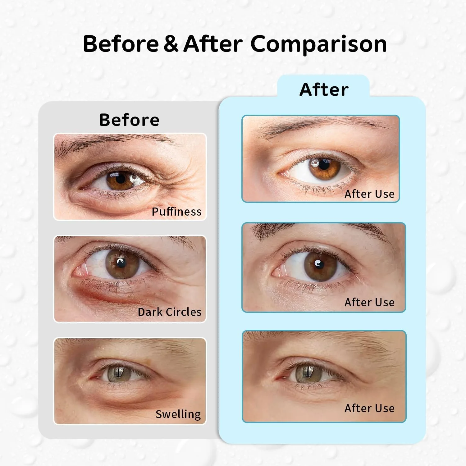 Hot and Cold Eye Pads, Reusable Eye Patches