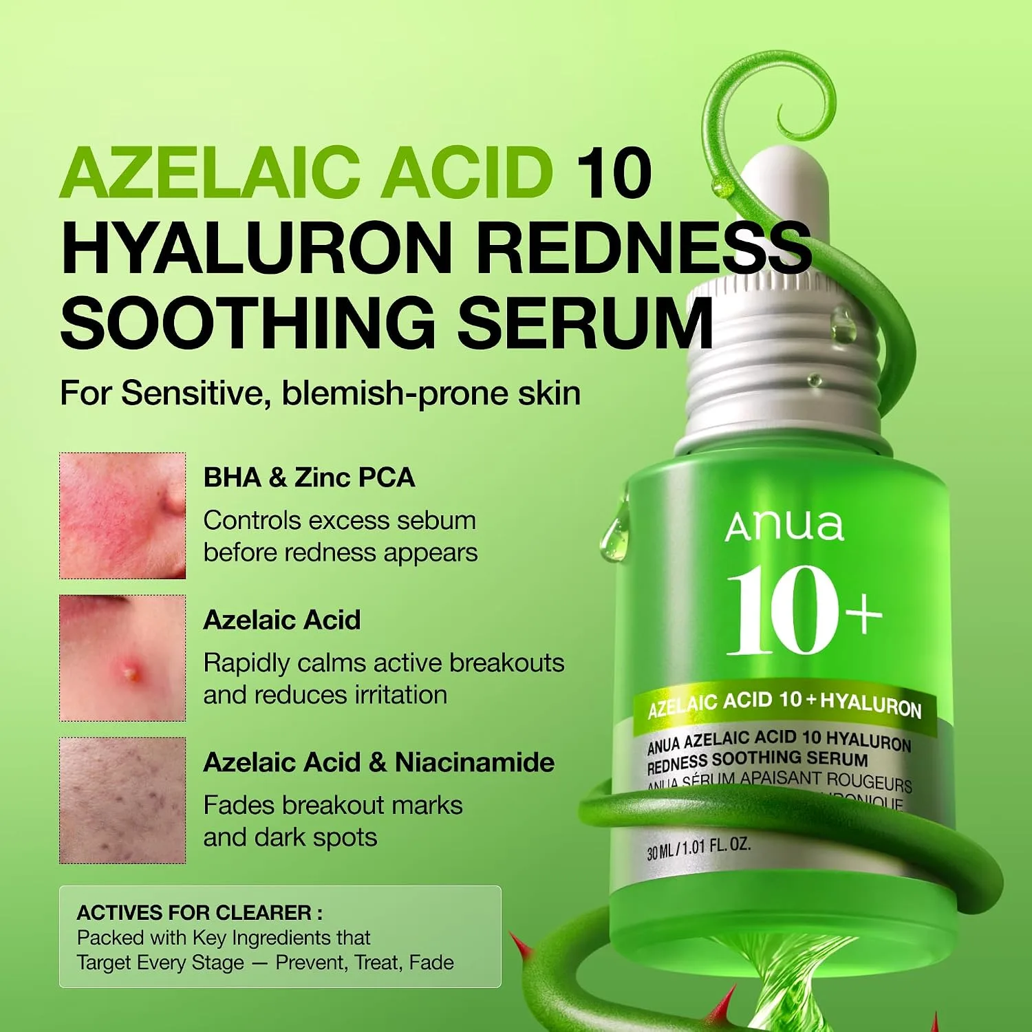 Anua Azelaic Acid 10 Hyaluron Redness Soothing Serum, 1.01 fl oz