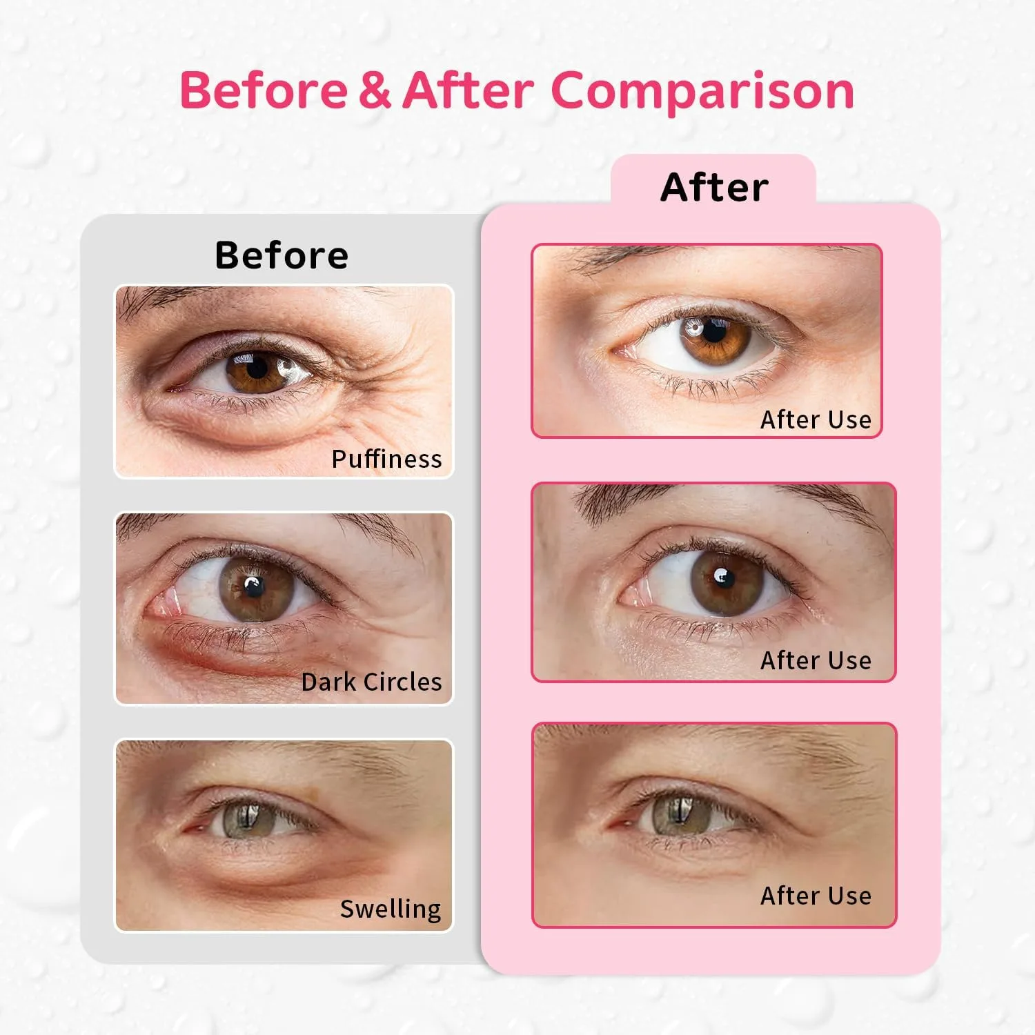 4PCS Gel Eye Ice Pack Set Reusable, Cold and Hot Compress for Eyes