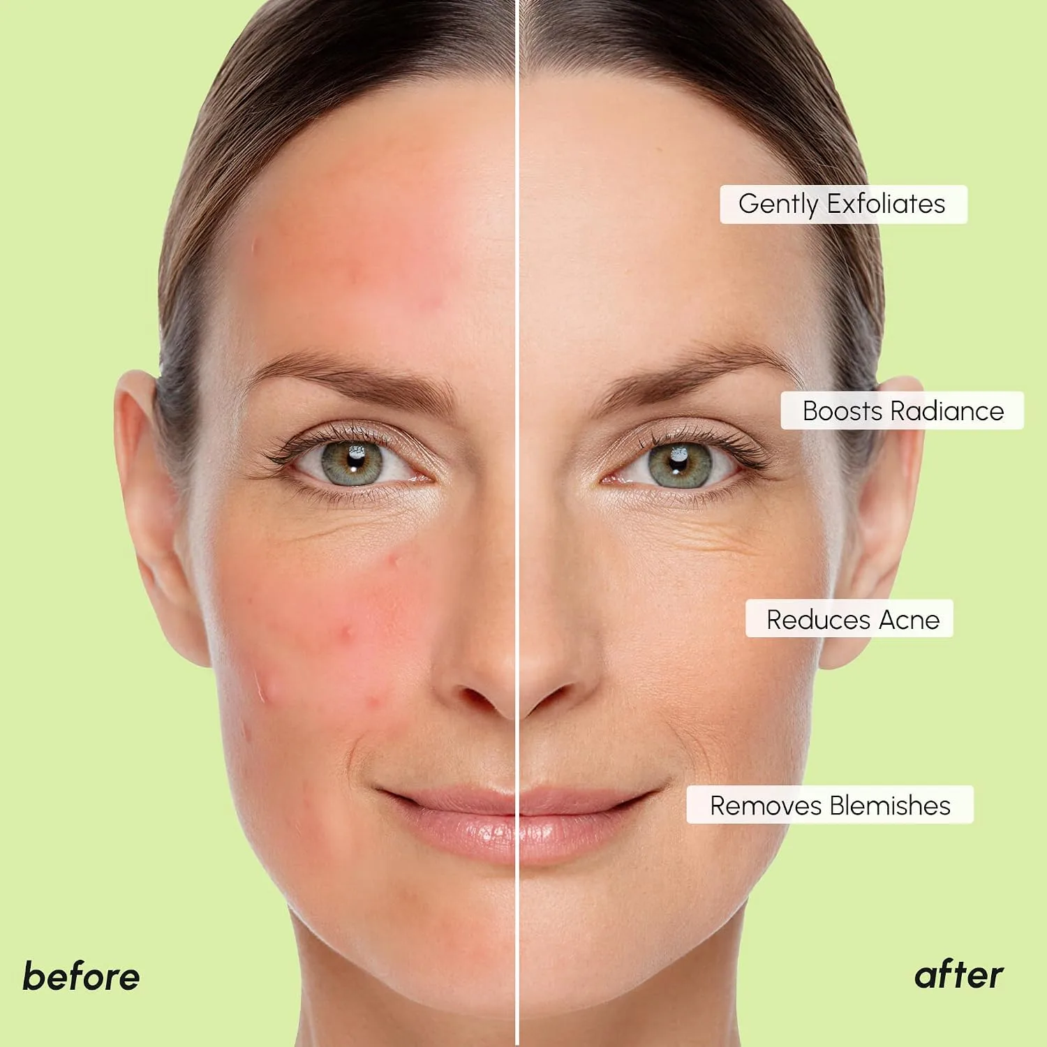 MAREE Blemish Toner Pads - Salicylic Acid Pads for Toning Exfoliating 90 Ct