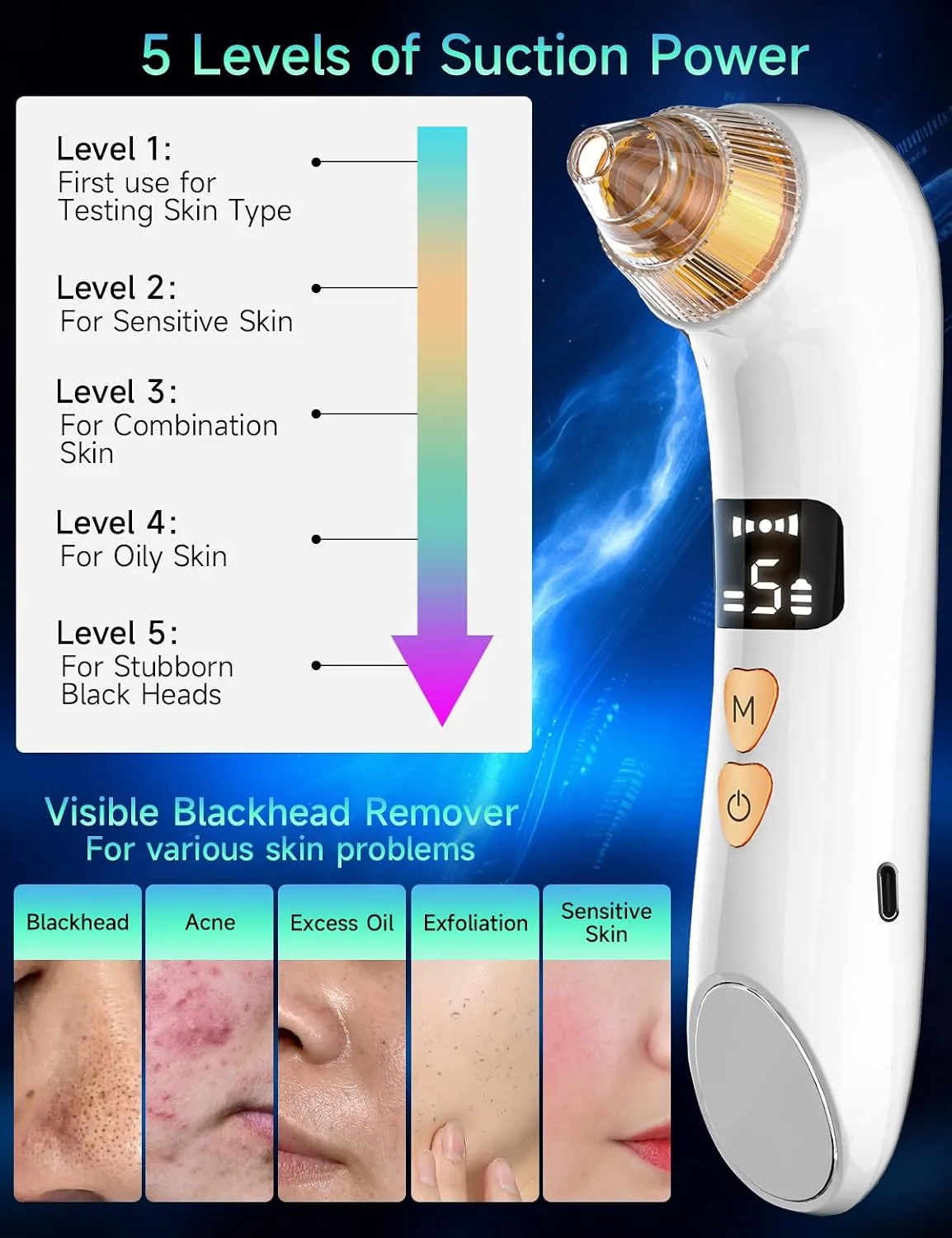 Upgraded Visible Blackhead Remover Pore Vacuum,5 Suction Levels,6 Probes