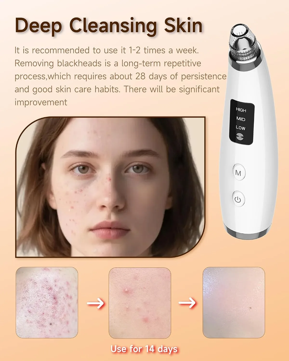 Blackhead Remover Vacuum, Type-C Rechargeable Pore Cleaner with 3 Adjustable Suction, 6 Probes & Comedone Extractor Tool Kit for Women and Men, White Heads Removal for Face & Nose (White)