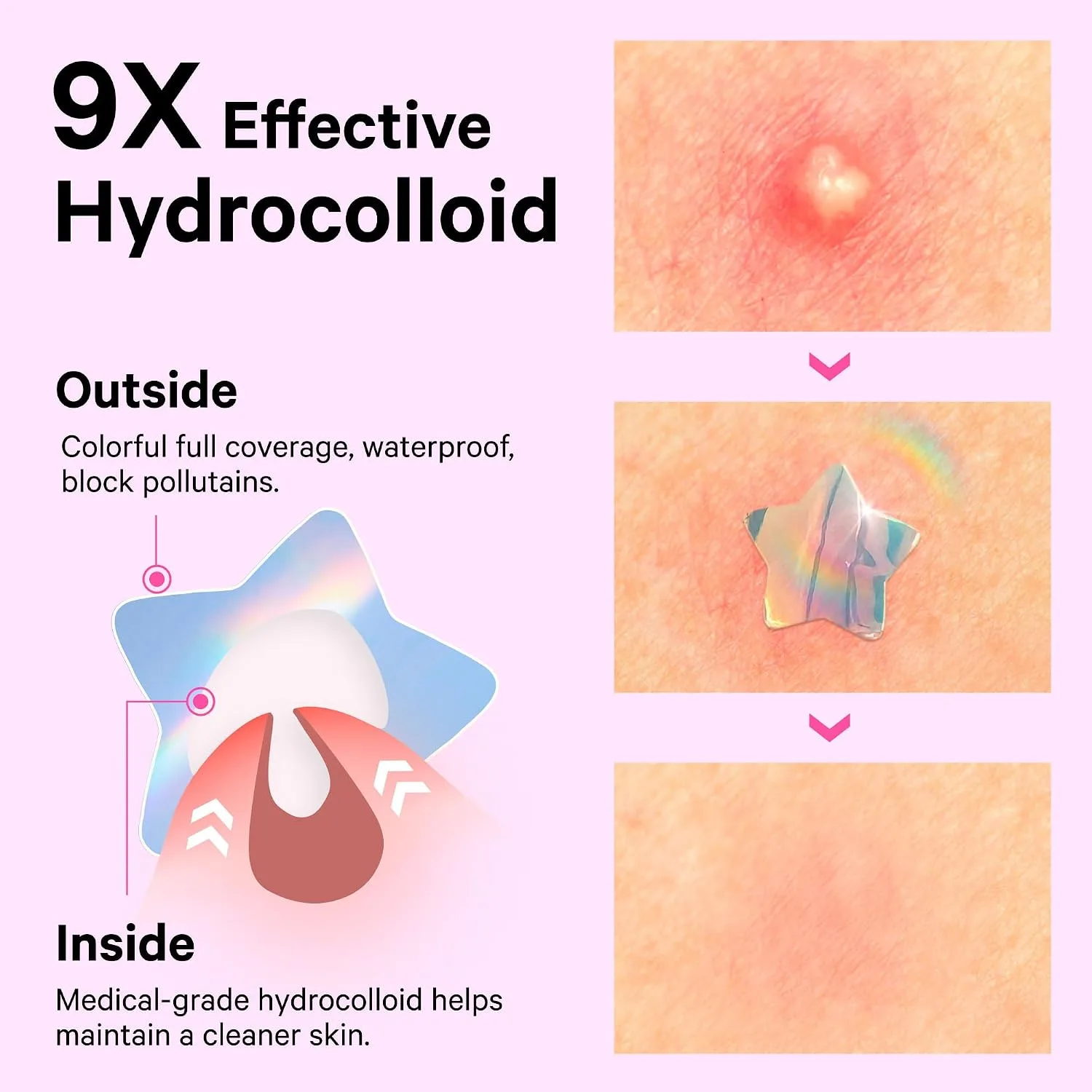 Sosky Holographic Star Pimple Patches, Hydrocolloid Acne Patches, 144 Count Pink Star Heart Moon Cloud Butterfly Flower
