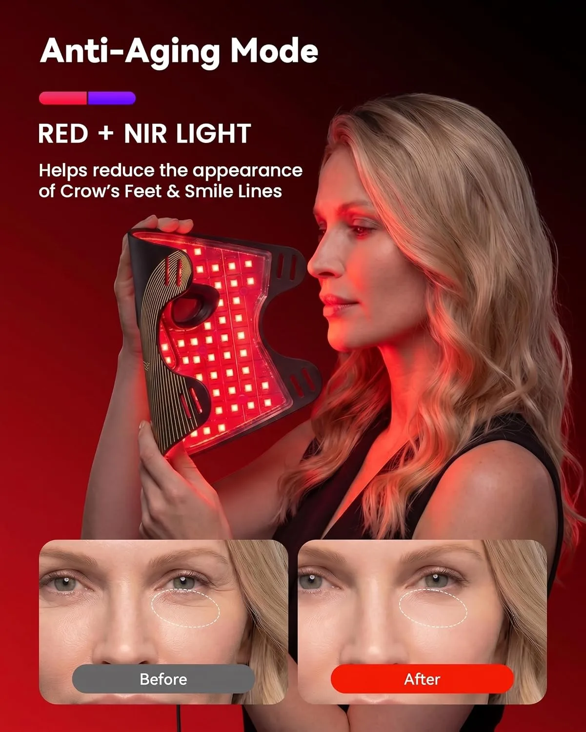 FDA-Cleared Blue Light Therapy for Acne with Mild-to-Moderate Inflammation