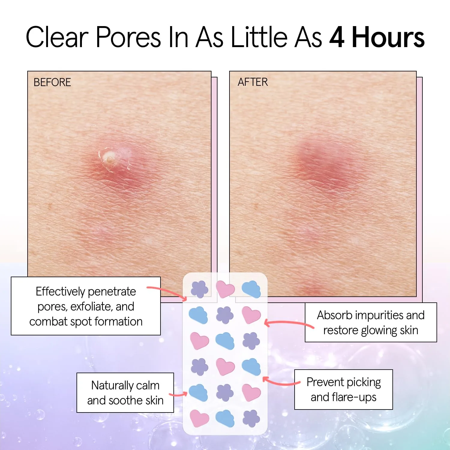 grace & stella Award Winning Pimple Patches for Face -72 Pack Multishape