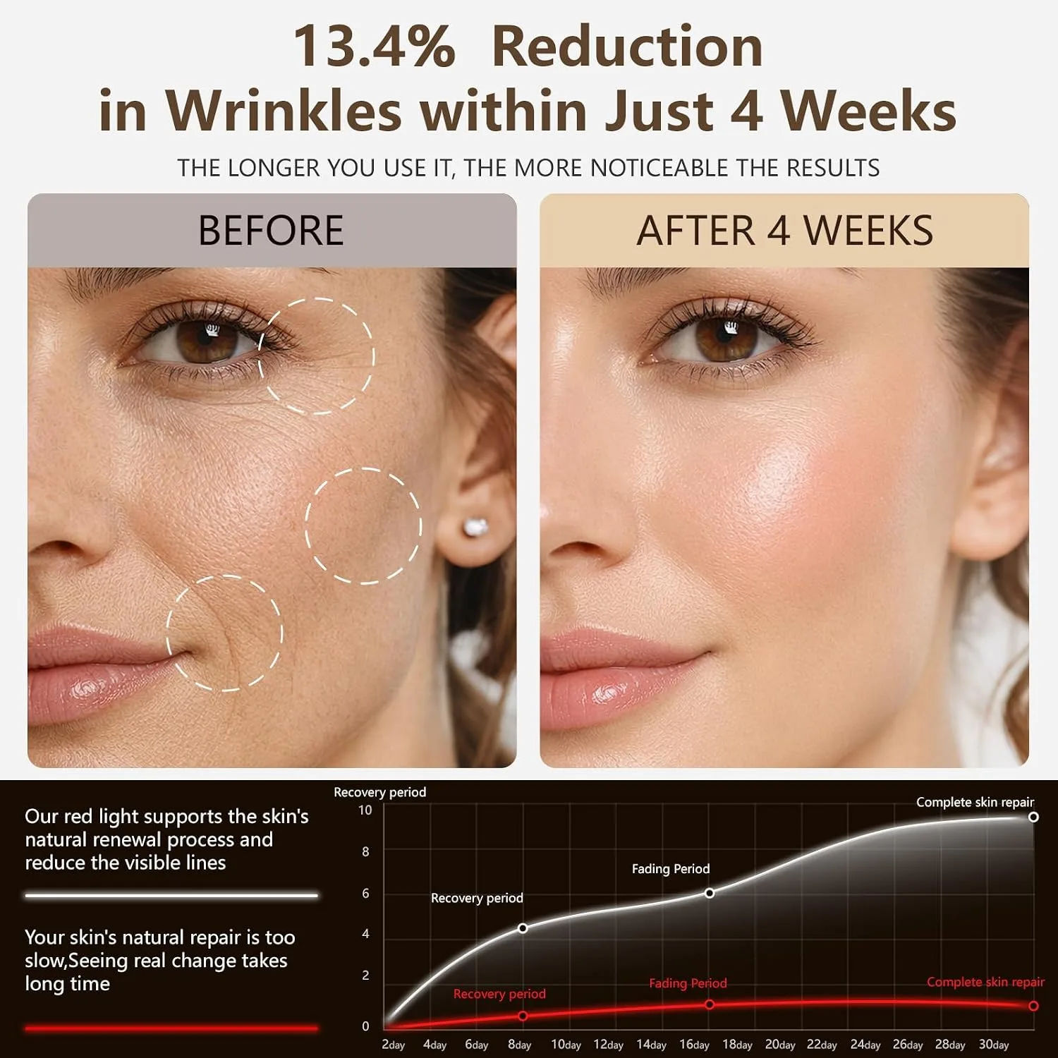 Wireless LED Light Therapy Face Mask, 850nm NIR 4-in-1 Modes 336 LEDs, 33mW/cm² Power Red Light Therapy Face Mask with 2000mAh Rechargeable 5/10/20-Min Timer for 180 Mins Use for Home Travel Yoga