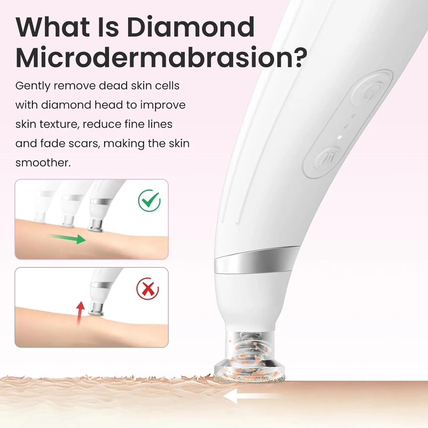UNOISETION Diamond Microdermabrasion Machine, Portable Blackhead Remover Pore Vacuum, Dermabrasion Facial Machine for Exfoliation & Blackhead Removal
