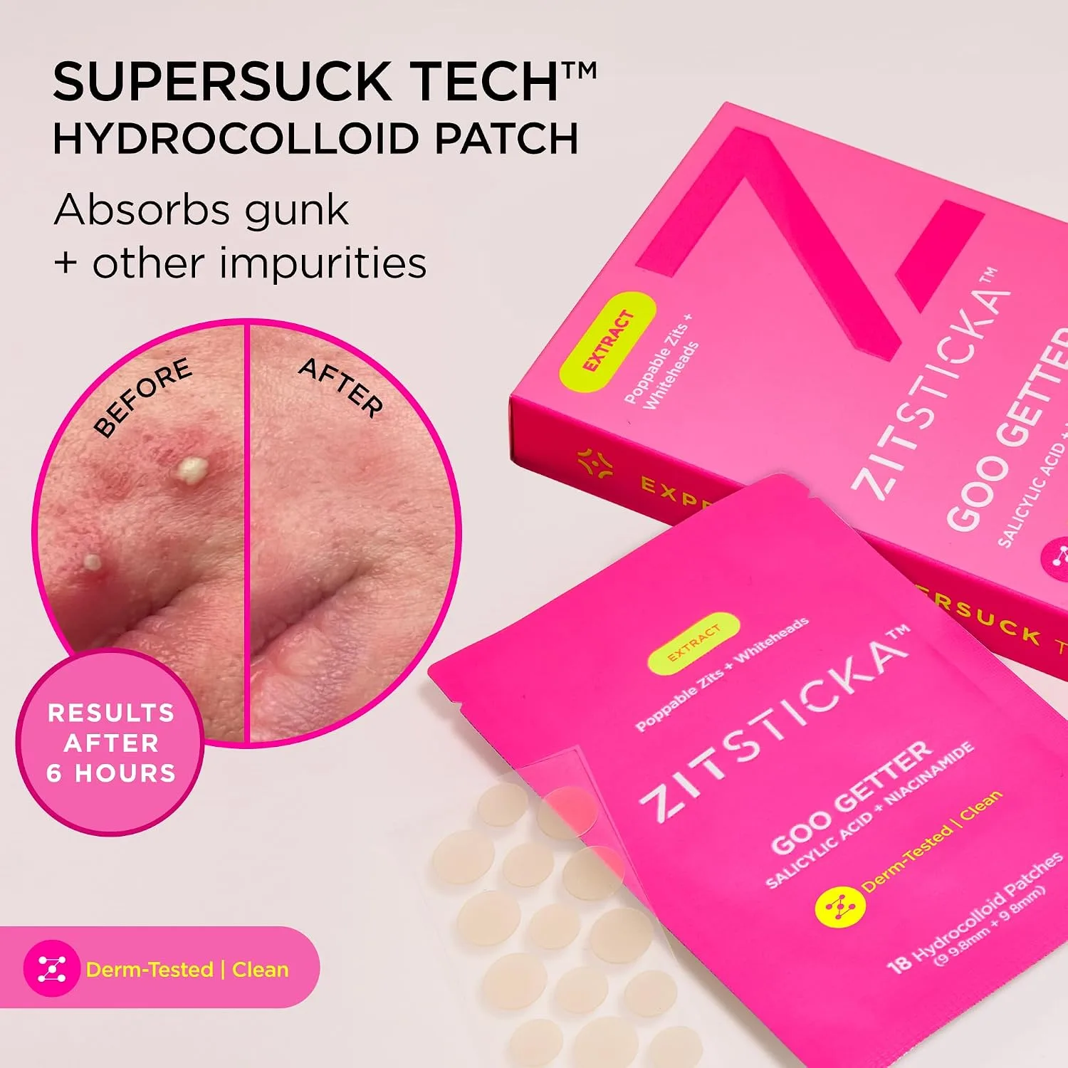 ZitSticka Pimple Patches for Face, Hydrocolloid Acne Patches, 108 Count