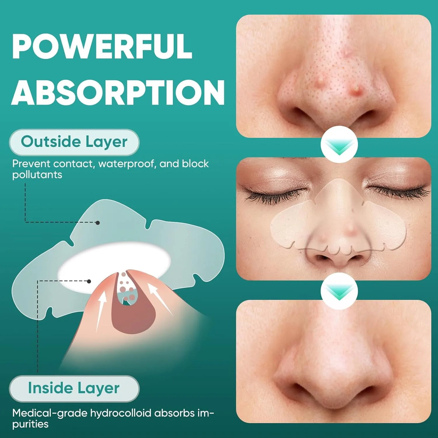 30 Count Hydrocolloid Nose Pore Patches