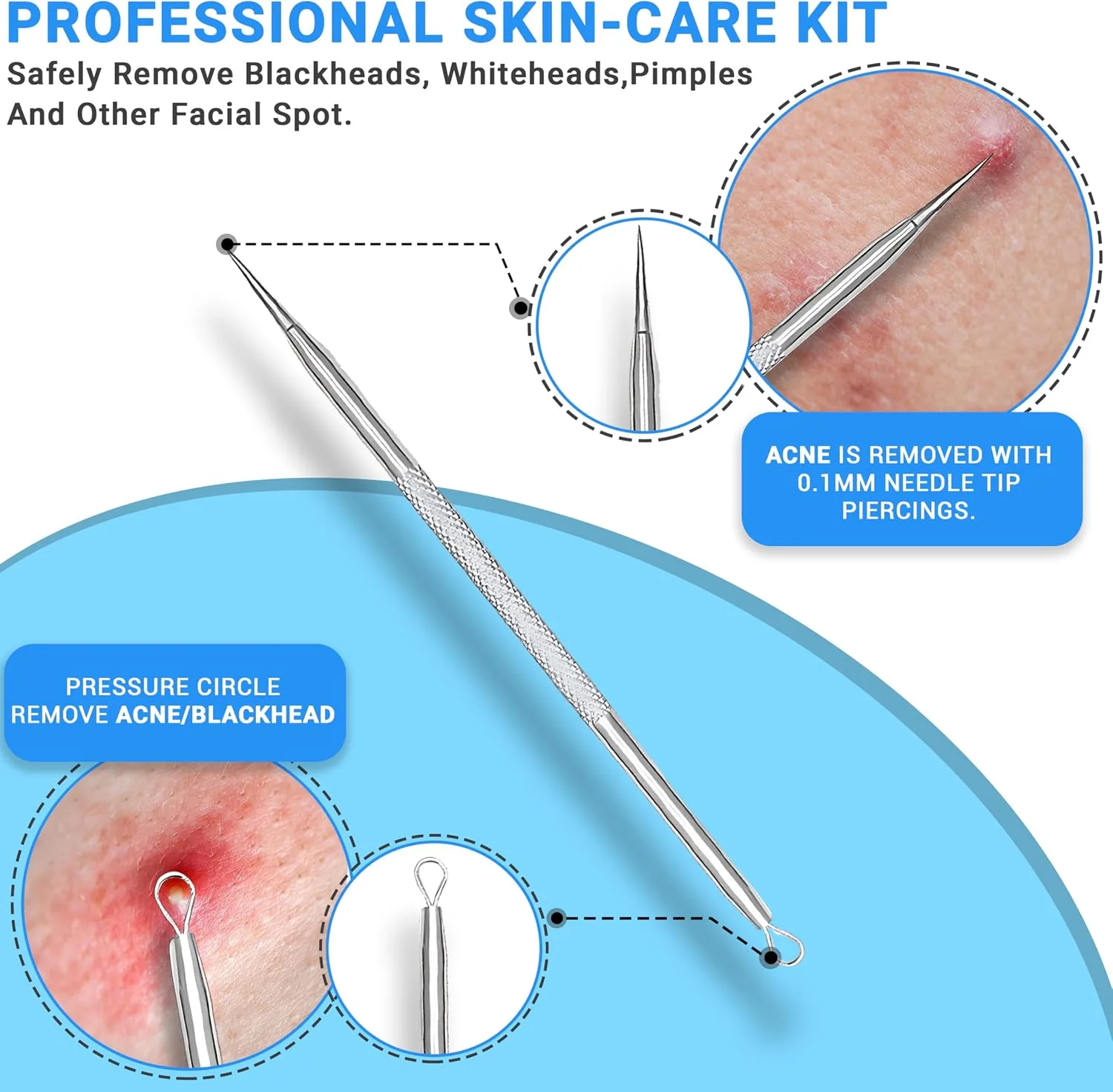 2Pcs Stainless Steel Pimple Extractor Acne Tool Surgical Blackhead Remover