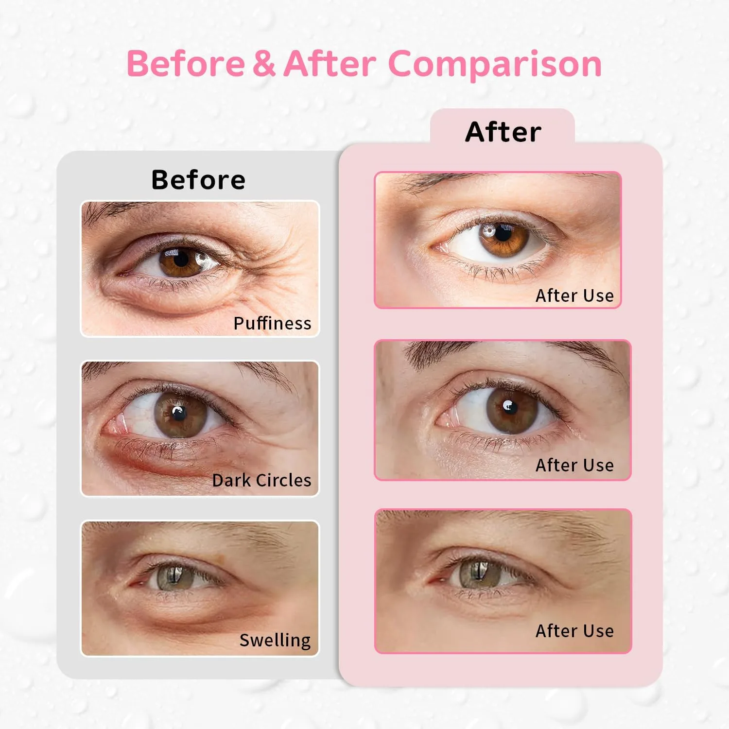 4PCS Gel Eye Ice Pack Set Reusable, Cold and Hot Compress for Eyes