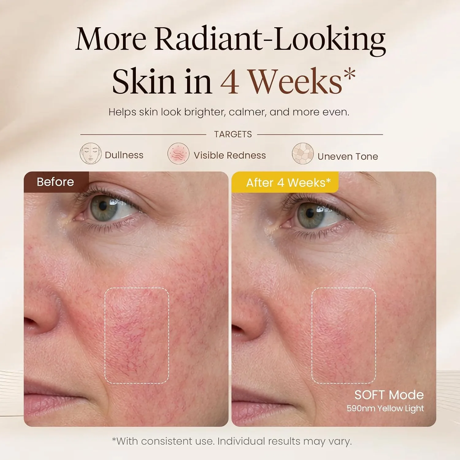 BOB AND BRAD Red Light Therapy for Face, FDA-Cleared LED Face Mask 480 LEDs