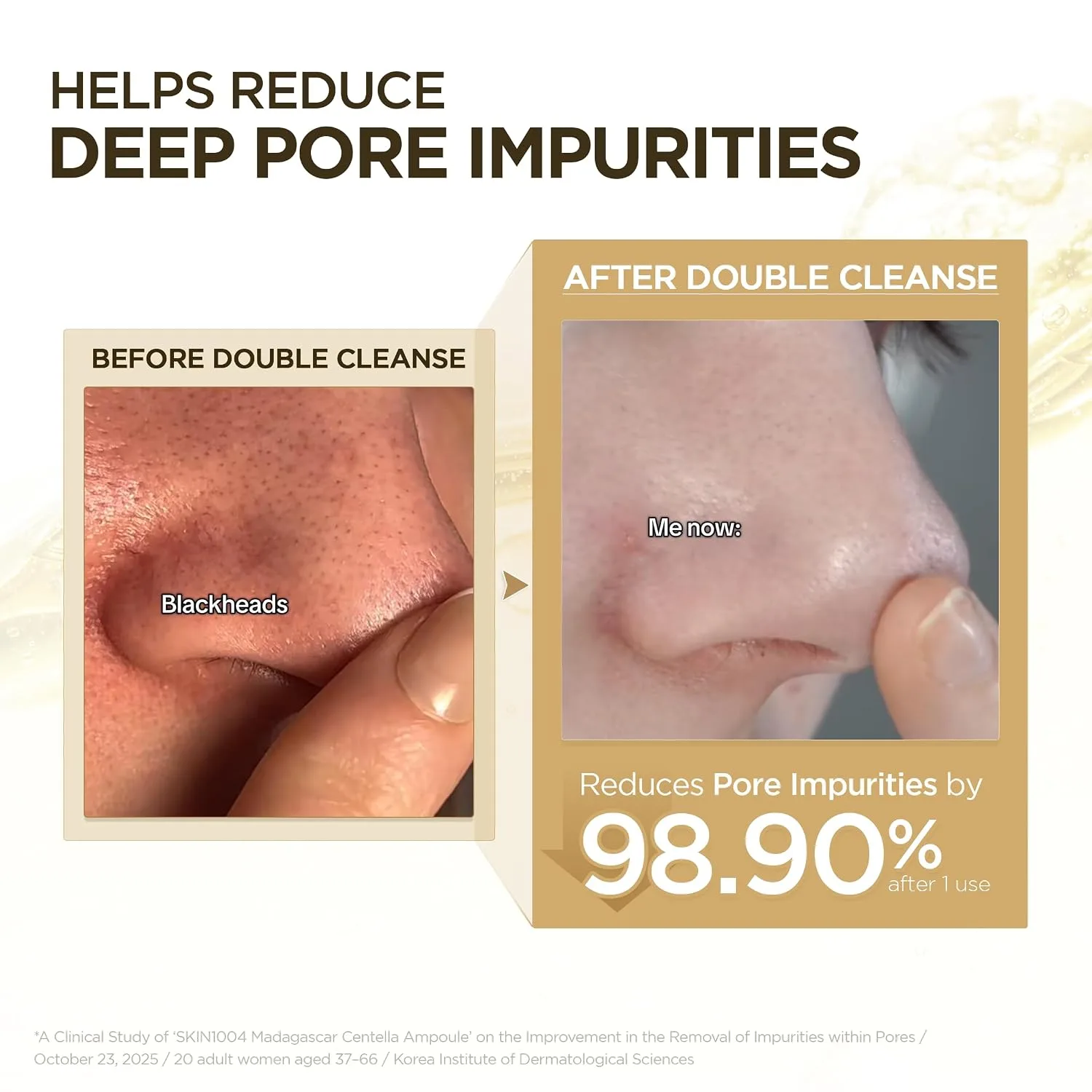 SKIN1004 Centella Double Cleansing Duo, Oil Cleanser, Face Wash 10.99 fl.oz