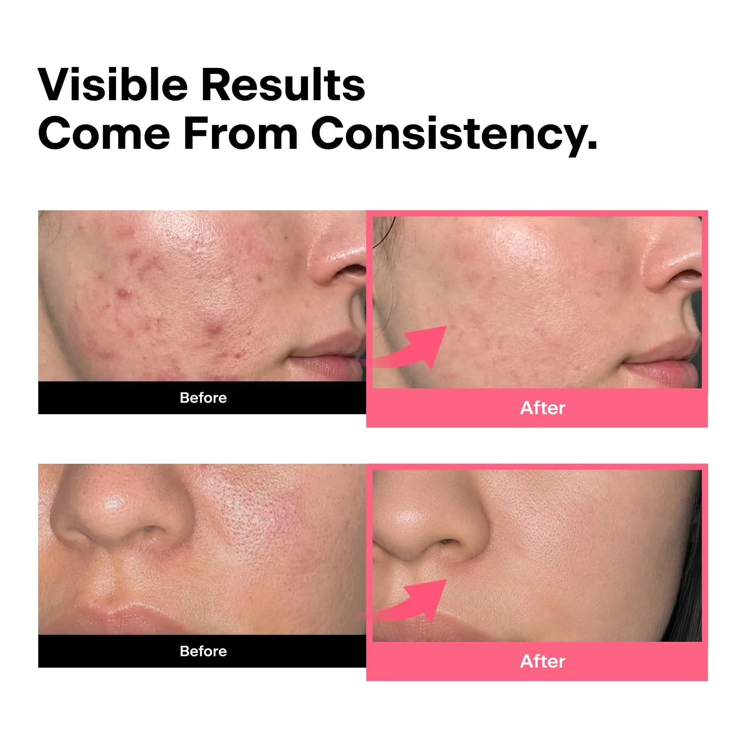 THOME Twenty Up, At-Home Skincare Ritual Tool for Calm, clear-looking skin