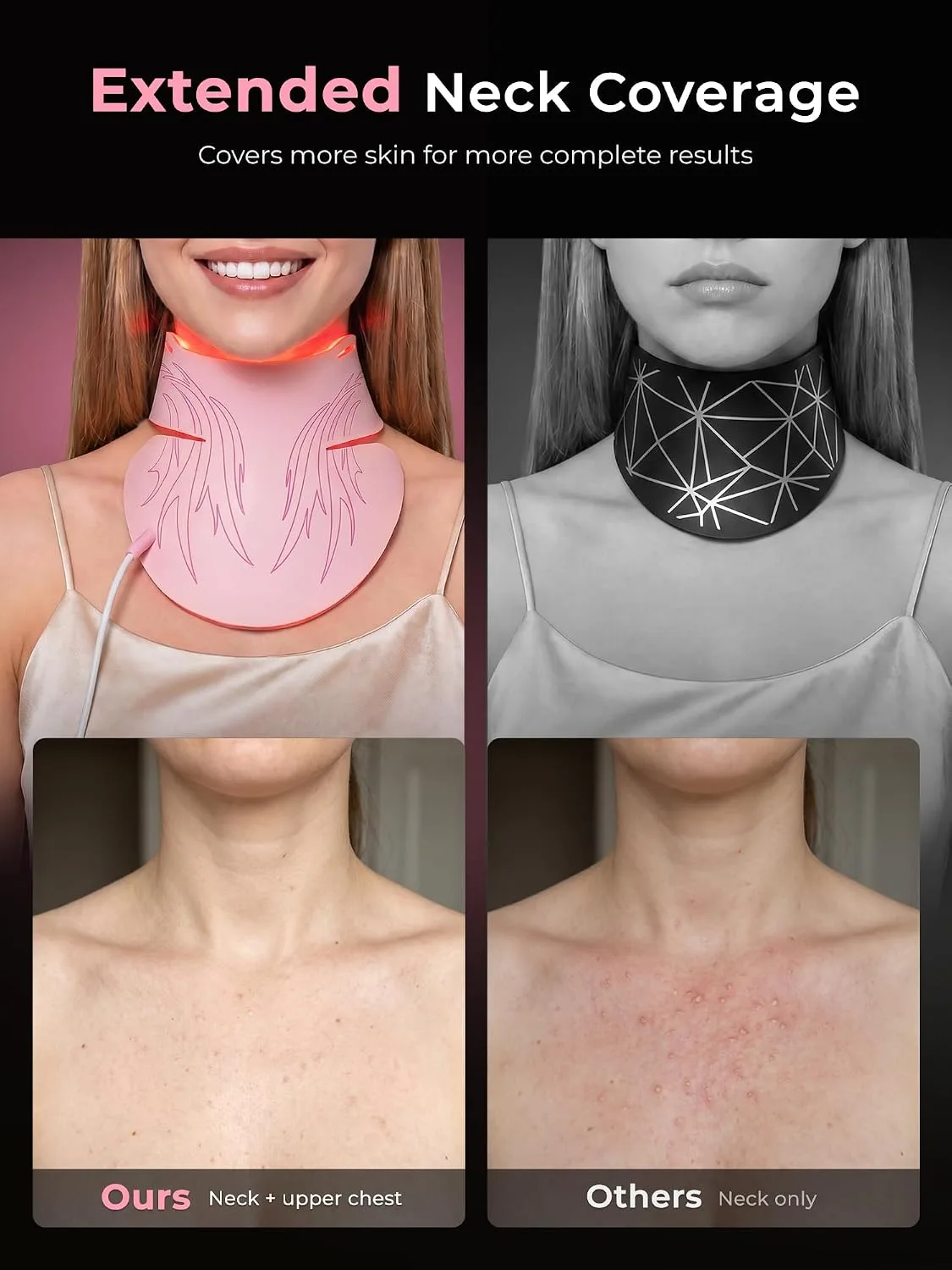 Red Light Therapy for Face & Neck, 850nm NIR LED Face Mask (M09), Rechargeable Light Therapy Mask - 240 Mins Use, Portable Home Skin Care Device for Anti-Aging & Skin Firming, Pink