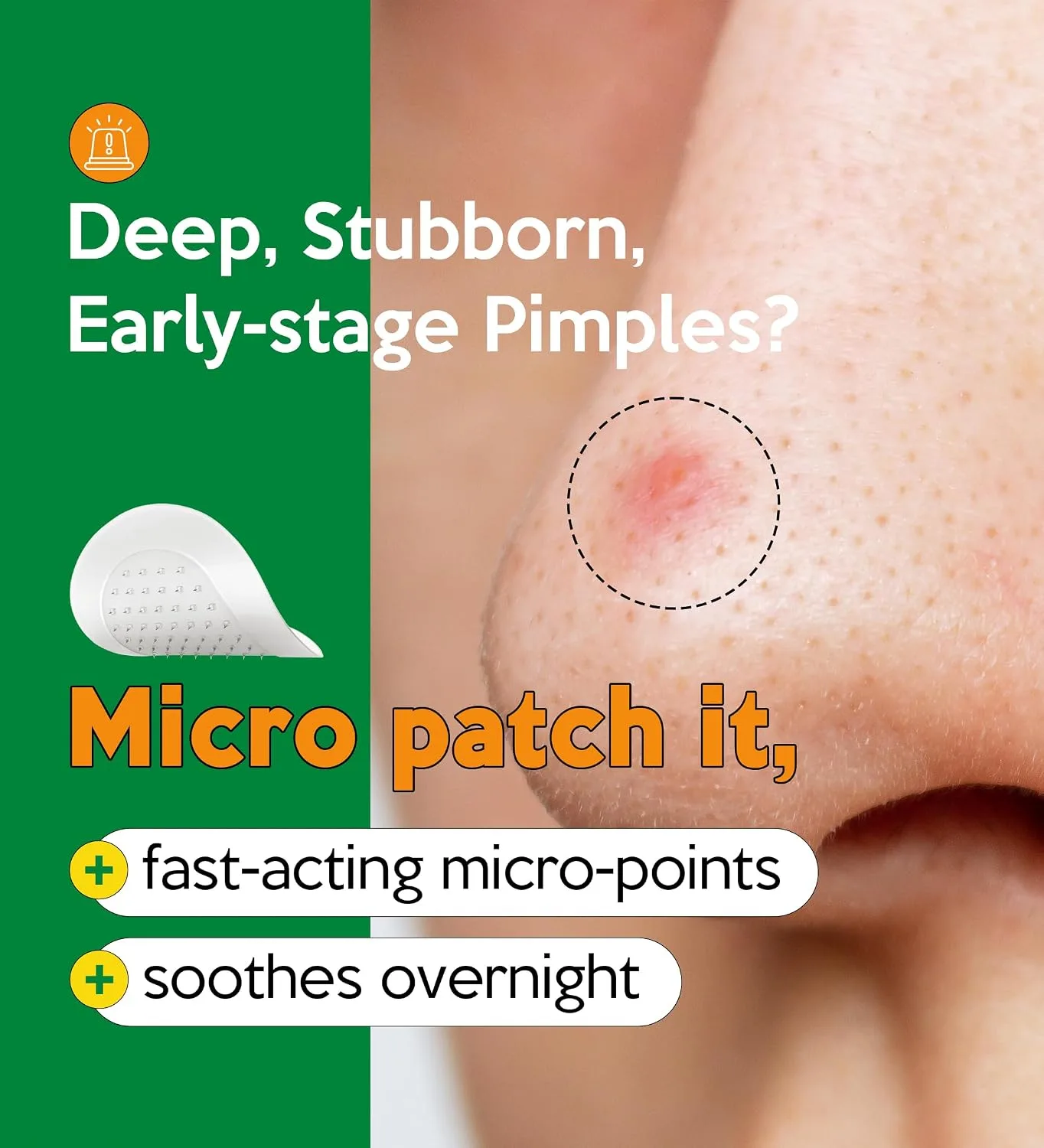 Troubless Micro-Point Patch Plus Limited Value Pack - Hydrocolloid 18EA