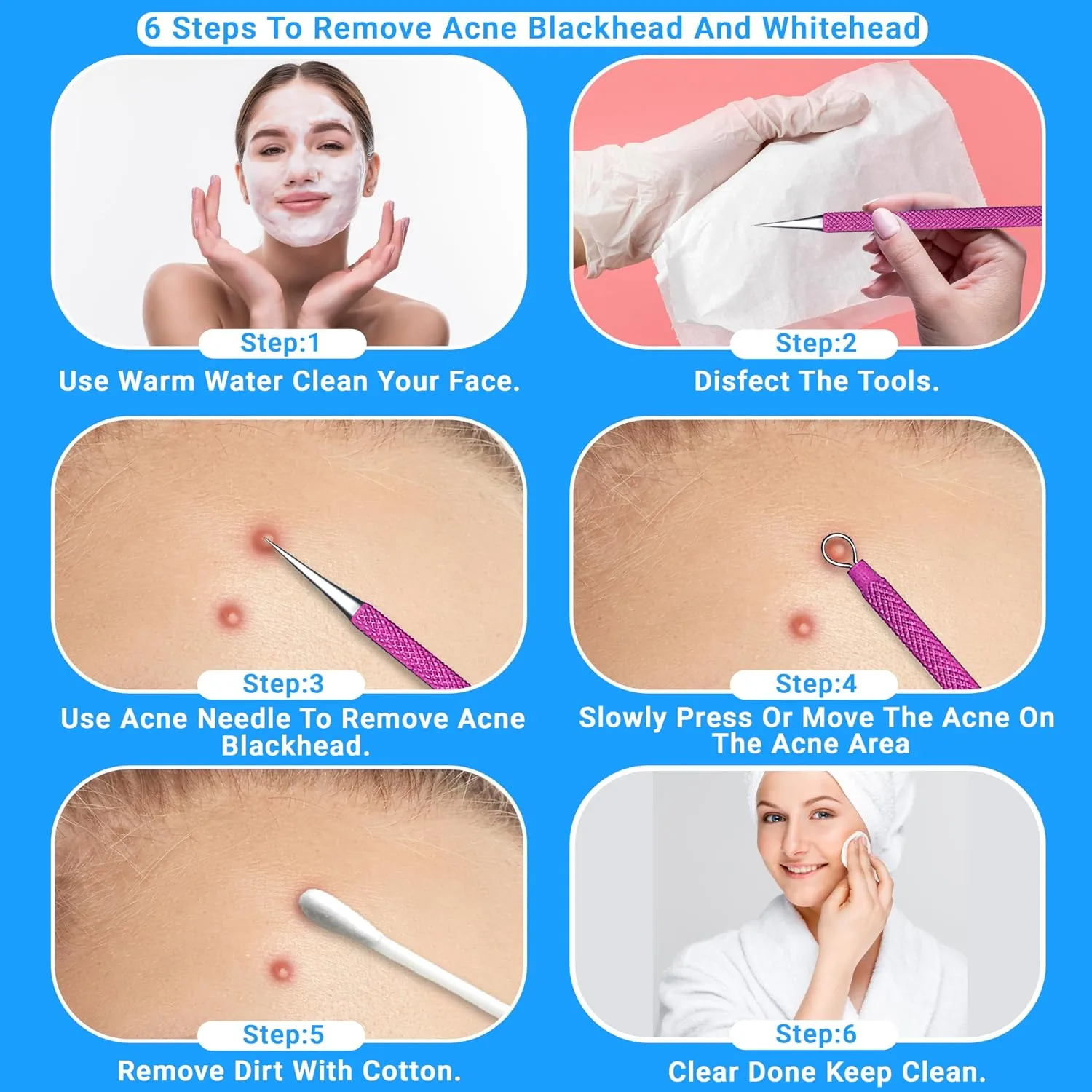 2Pcs Stainless Steel Pimple Extractor Acne Tool Surgical Blackhead Remover