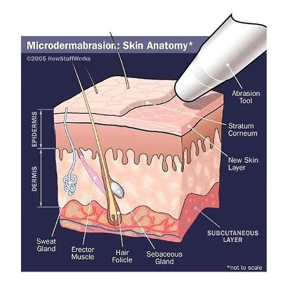 NeedCrystals Microdermabrasion Crystals for Machines, All-Natural Facial Exfoliating Treatment for Dull or Dry Skin, Wrinkles, Blemishes, Scars & More (4 lb, 100 Grit)